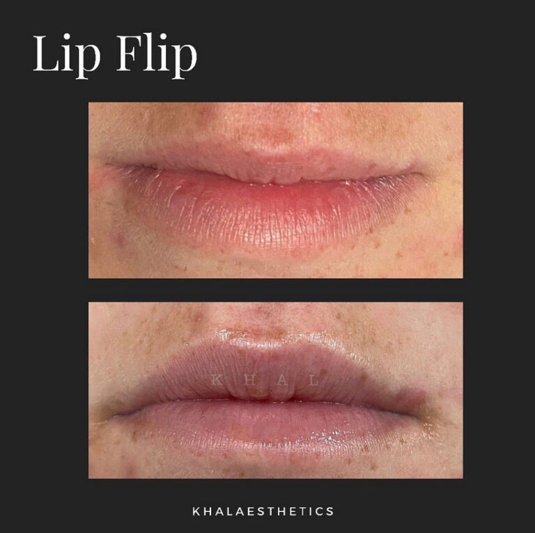 lipflip