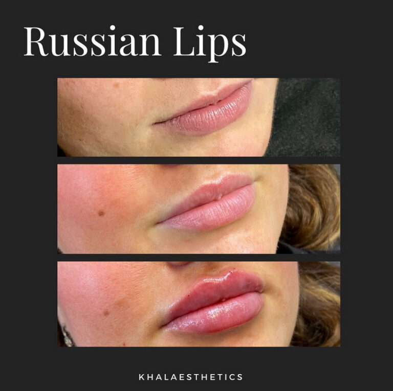 russian-lips